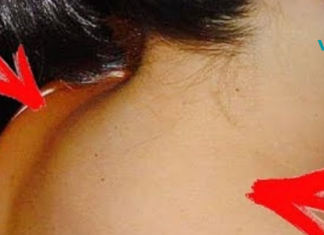 ამ პიროვნებას მარილები დაუგროვდა კისერზე… წაიკითხეთ ეს სტატია და მისი დახმარებით მოიშორეთ ტკივილები!