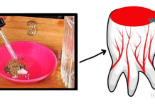საშინაო საშუალებები კბილის ტკივილის წინააღმდეგ!! სასწრაფო დახმარებაა გამოუვალ სიტუაციებში..