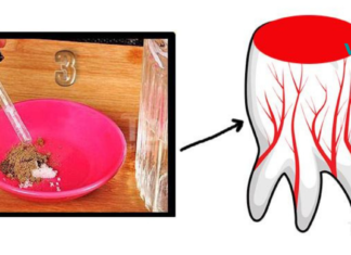 საშინაო საშუალებები კბილის ტკივილის წინააღმდეგ!! სასწრაფო დახმარებაა გამოუვალ სიტუაციებში..