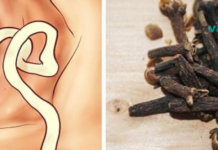 როგორ ვიმკურნალოთ ჭიებზე სახლის პირობებში? ეს მეთოდები საკმაოდ მარტივი და ეფექტურია