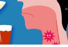 როგორ მოვიშოროთ ანთებითი ტონგალები სწრაფად 24 საათის განმავლობაში..!