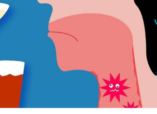 როგორ მოვიშოროთ ანთებითი ტონგალები სწრაფად 24 საათის განმავლობაში..!