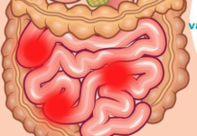 ექიმები გირჩევენ! ეს 2 ინგრედიენტი გამოდევნის 9 კგ-მდე ტოქსინებს და ნარჩენებს ორგანიზმიდან.