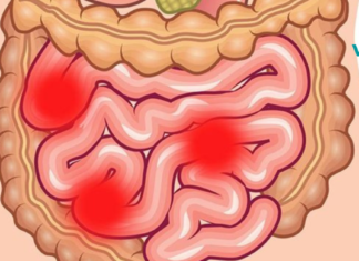 ექიმები გირჩევენ! ეს 2 ინგრედიენტი გამოდევნის 9 კგ-მდე ტოქსინებს და ნარჩენებს ორგანიზმიდან.