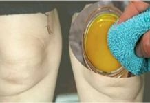 ამ პროდუქტით და პირსახოცით თქვენ აღარ მოგიწევთ მუხლის ტკივილის განმეორებით განცდა..!! ნამდვილი აღმოჩენაა