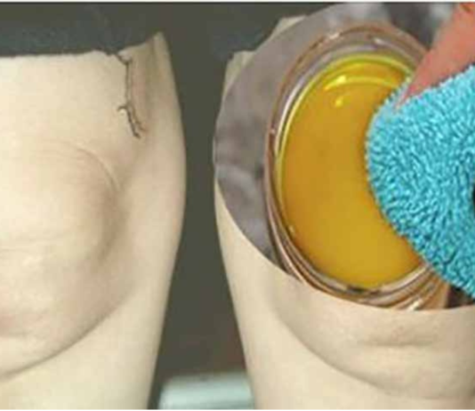 ამ პროდუქტით და პირსახოცით თქვენ აღარ მოგიწევთ მუხლის ტკივილის განმეორებით განცდა..!! ნამდვილი აღმოჩენაა