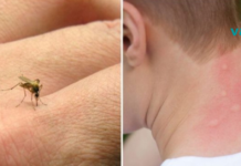 მარტივი ხრიკის წყალობით კოღოები ათობით მეტრის რადიუსზეც ვეღარ მოგეკარებიან! დროა თქვენც იცოდეთ ამის შესახებ..