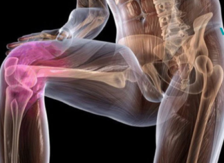 სახსრებისა და ძვლების ტკივილის საწინააღმდეგო 6 ბუნებრივი საშუალება!