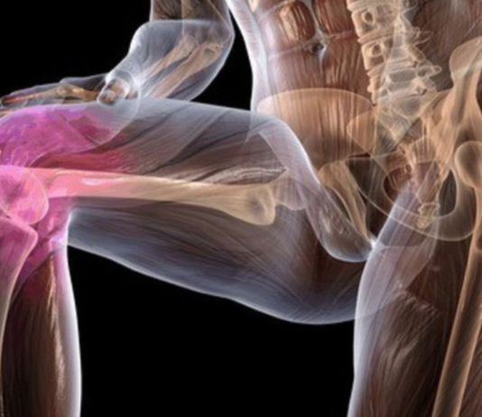 სახსრებისა და ძვლების ტკივილის საწინააღმდეგო 6 ბუნებრივი საშუალება!