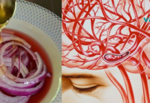 გაიწმინდეთ თავის ტვინის სისხლძარღვები ამ ნატურალური რეცეპტების საშუალებით..