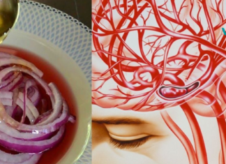 გაიწმინდეთ თავის ტვინის სისხლძარღვები ამ ნატურალური რეცეპტების საშუალებით..