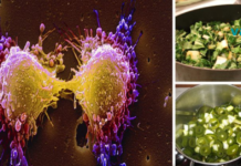 საკვები, რომელიც იწვევს დაავადებებული უჯრედების “სიკვდილს”, აშორებს ტოქსინებს და ხსნის თავისუფალ რადიკალებს!