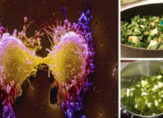 საკვები, რომელიც იწვევს დაავადებებული უჯრედების “სიკვდილს”, აშორებს ტოქსინებს და ხსნის თავისუფალ რადიკალებს!