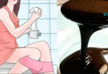 ამ ხელნაკეთი ბუნებრივი საფაღარათო საშუალების მხოლოდ ერთი კოვზი გაათავისუფლებს ნაწლავებს ერთ საათზე ნაკლებ დროში!