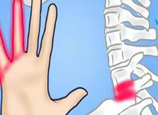 რატომ ჩნდება ხელებში დაბუჟების და ჩხვლეტის შეგრძნება? 7 მიზეზი, რომ მეტი ყურადღება მიაქციოთ თქვენს ჯანმრთელობას!