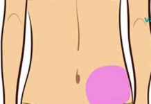 აღმოაჩინეთ კუჭის ტკივილის მიზეზი მხოლოდ ზუსტი ადგილის ცოდნით!