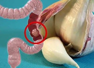 მსხვილი ნაწლავის დაავადებების 50%-ის პრევენცია შესაძლებელია ამ 9 საშუალების დახმარებით!