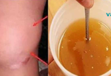 ეს ჯანსაღი სიროფი აღადგენს ძვლებს და ხსნის სახსრების ტკივილს!