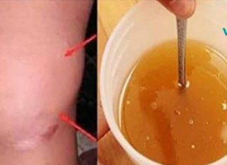 ეს ჯანსაღი სიროფი აღადგენს ძვლებს და ხსნის სახსრების ტკივილს!