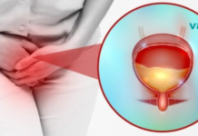 უდავოა, მილიონობით ადამიანი იტანჯება შარდის შეუკავებლობით! აქ კი მოცემულია 6 ბუნებრივი გზა ამის შესაჩერებლად..