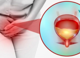 უდავოა, მილიონობით ადამიანი იტანჯება შარდის შეუკავებლობით! აქ კი მოცემულია 6 ბუნებრივი გზა ამის შესაჩერებლად..