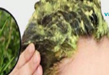 თუ დაიღალეთ ჭაღარა თმის შეღებვით, აღიარეთ ეს საშუალება! საღებავი აღარცაა საჭირო!