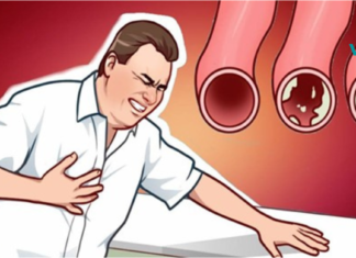 გარკვეული საკვების ჩამონათვალი, რომელიც ბუნებრივად გაწმენდს თქვენს არტერიებს და დაგიცავთ გულის შეტევისგან!