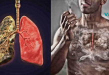 “5 წლიანი მოწევის შემდეგ, როგორც წესი, უვითარდებათ მწეველის ხველა, რომელიც განსაკუთრებით აწუხებთ დილის საათებში ხოლმე”.. როგორ დავაღწიოთ თავი ამ ყოველივეს?