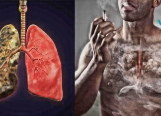 “5 წლიანი მოწევის შემდეგ, როგორც წესი, უვითარდებათ მწეველის ხველა, რომელიც განსაკუთრებით აწუხებთ დილის საათებში ხოლმე”.. როგორ დავაღწიოთ თავი ამ ყოველივეს?