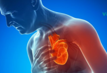 ექიმები გვირჩევენ: 5 მარტივ საშუალებას, რომელსაც შეუძლია თავიდან აგაცილოთ გულის შეტევა 80%-ით