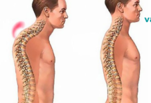 გსურს გქონდეს ჯანსაღი ხერხემალი? არაფერია ამაზე უფრო ადვილი!