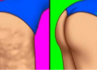 ჩვევები, რომლებიც დაგეხმარება გლუვი და ლამაზი კანის მიღებაში!!