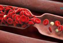 8 ადრეული გამაფრთხილებელი ნიშანი სისხლის საათის შესახებ, რომელიც არასოდეს უნდა დააიგნოროთ!