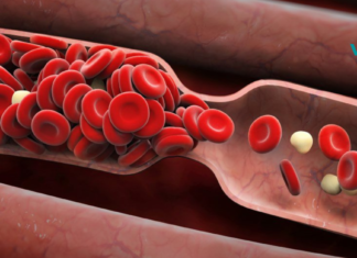 8 ადრეული გამაფრთხილებელი ნიშანი სისხლის საათის შესახებ, რომელიც არასოდეს უნდა დააიგნოროთ!