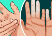 ხელები და ფეხები ხშირად გიცივდებათ? ის, რაც სისხლის მიმოქცევას დაგირეგულირებთ..