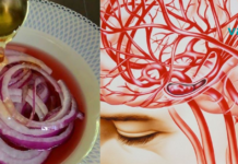 გაიწმინდეთ თავის ტვინის სისხლძარღვები ამ ნატურალური რეცეპტების საშუალებით. .