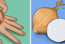 ამ ქალმა ხელზე უმი ხახვი დაიდო და საოცარი შედეგი მიიღო. ეს თქვენც გამოგადგებათ!