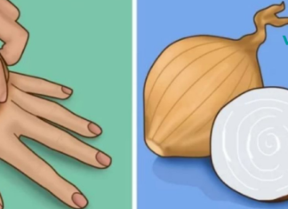 ამ ქალმა ხელზე უმი ხახვი დაიდო და საოცარი შედეგი მიიღო. ეს თქვენც გამოგადგებათ!