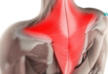 კისრის და ზურგის კუნთოვანი დამჭერები: ტკივილის შემსუბუქება პოზის შეცვლით