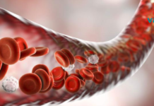 როგორ გავწმინდოთ ვენები მხოლოდ 3 ინგრედიენტით?!..