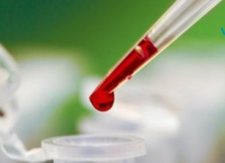 გაწუხებთ ჯანმრთელობის პრობლემები? შესქელებული სისხლი: რა უნდა იცოდეთ ამ დროს..