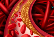 10 საკვები, რომელიც დაგეხმარებათ არტერიების გაწმენდაში..