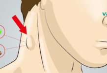 10 მარტივი გზა ლიმფური სისტემის გასაწმენდად. მხოლოდ ბუნებრივი საშუალებებით