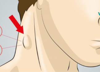 10 მარტივი გზა ლიმფური სისტემის გასაწმენდად. მხოლოდ ბუნებრივი საშუალებებით