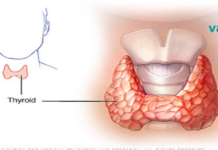 თქვენი ექიმისგან ამას ვერასდროს გაიგებთ: როგორ განკურნოთ ფარისებრი ჯირკვალი მხოლოდ ორი ინგრედიენტით