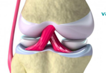 ამას ყველა ქირურგი მალავს! ასე მკურნალობენ სახსრებს სახლის პირობებში. .