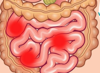 ამ 2 ინგრედიენტს გამოაქვს ორგანიზმიდან 9 კგ-მდე ტოქსინები და ნარჩენები. ექიმები გირჩევენ!