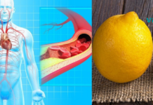 არტერიების გასუფთავება ნიორის და ლიმონის დახმარებით. ყველაზე ეფექტური საშუალებაა!