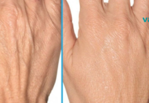 ნატურალური რეცეპტები ხელის კანისთვის. დაუბრუნეთ თქვენს კანს ახალგაზრდობა