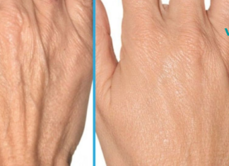 ნატურალური რეცეპტები ხელის კანისთვის. დაუბრუნეთ თქვენს კანს ახალგაზრდობა